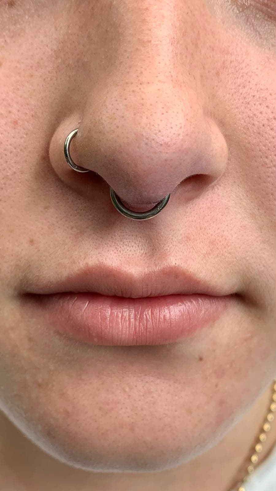Septum